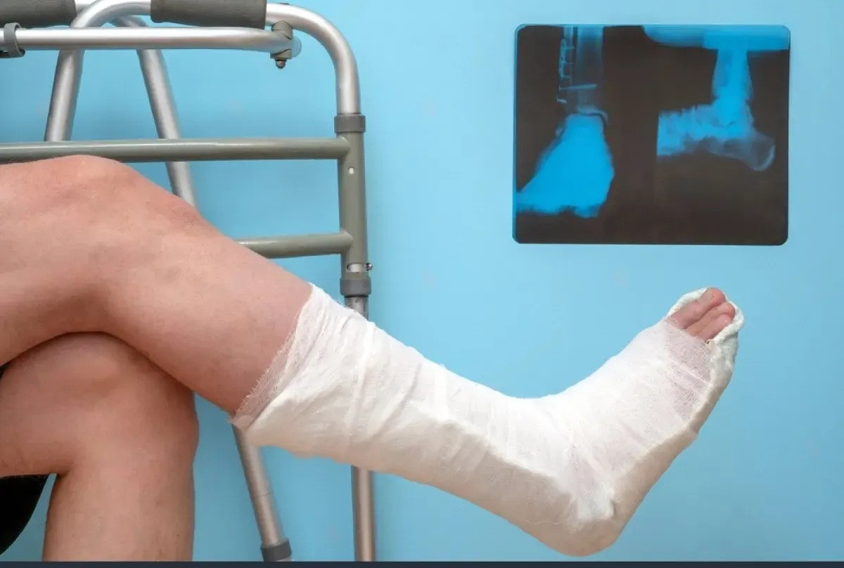 Austin Car Accident Lawyer Highlights Rising Local Accident Trends